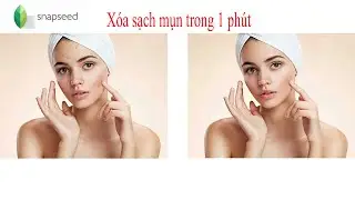 Xo&aacute; mụn 1 ph&uacute;t với App Snapseed thần th&aacute;nh