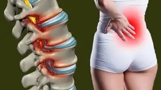 Lower Back Pain When Standing Or Walking: Causes And Prevention