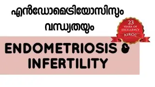 ENDOMETRIOSIS AND INFERTILITY,# DR SAM P ABRAHAM#ivf Kerala#best infertility treatment Kottayam