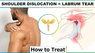 How to find orthopedic surgeon for arthroscopic shoulder labral tear repair | Shoulder dislocation