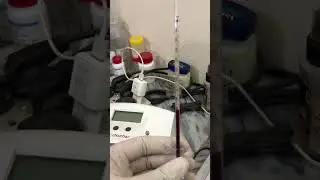 High ESR 😮#foryou #esrtest#mltips #lablife