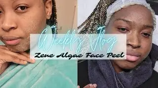 Chemical Face Peel for the first time!!! In Toronto's best esthetician!