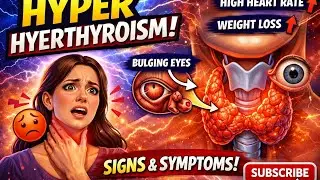 Hyperthyroidism/Endocrine Disorder/B.sc Nursing 3rd semester lecture GNM 🧠