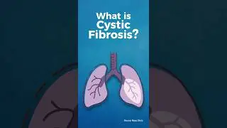 Cystic Fibrosis: The Disease That Turns Your Lungs To Slush