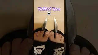 webbed toes Vs footless Joe 🦶🔪