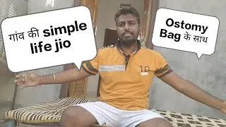 Living simple life with Ostomy bag | How to live happily after Cancer treatment  Jaichand Rajasthani