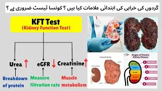 What is Renal Function Test (RFT) I Kidney Function Test (KFT)