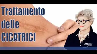 Trattamento delle Cicatrici - Dott.ssa Giordani