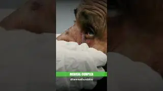 Mareez Ki Ayadat | Hammad Foundation #shortsvideo #foryou #medicalcomplex #suggested #asmr #karachi