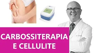 Carbossiterapia per la cellulite delle gambe: Dott. Masolini, Alessandria