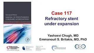 Case 117: PCI Manual - Refractory stent underexpansion