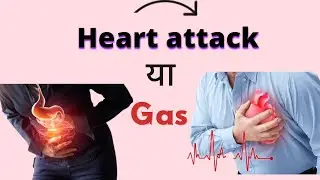 Heart Attack vs Gas Pain | Clear Difference in 3 Minutes | Life-Saving Tips