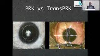 AIOS2025 IC286 T Dr Rishi SWARUP Approach to Surface Ablation in Refractive Practice