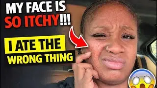 MY FACE SO ITCHY 
