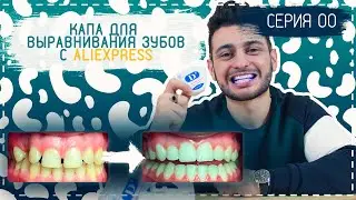 Бюджетная капа для выравнивания зубов | Распаковка с Aliexpress  | Серия [00]