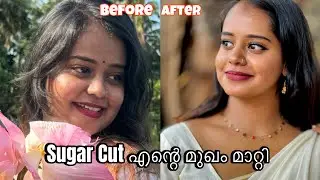 എന്റെ മുഖം എങ്ങനെ Slim ആയി?| SugarCut കൊണ്ടുള്ള എന്റെ അനുഭവം | എങ്ങനെ sugar cut ചെയ്യാം ✅