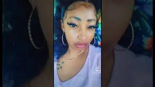 #lacefrontinstall