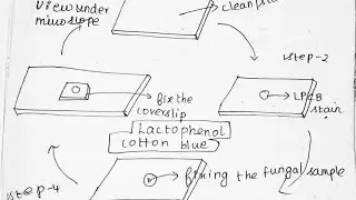 Lacto phenol cotton blue staining   in Tamil /LPCB in Tamil