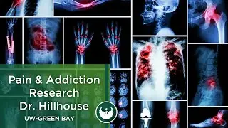 UW-Green Bay: Award Recognition for Pain and Addiction Research by Dr. Todd Hillhouse
