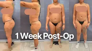 1 Week Post Op AirSculpt Vlog | Faja Fitting & Doctor Appointment