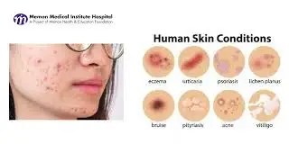 Understanding Plastic Surgery | Dr. Fahmina Buriro | MMI Hospital