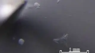 Cyclopoid copepod 5th leg dissection
