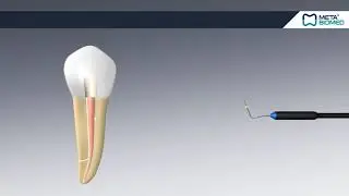 Meta Biomed EQV Endodontic Obturation System - How To Use - DENTBEAR