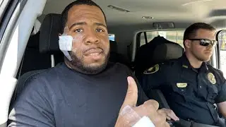 Covington Police officer shot in face provides update on recovery