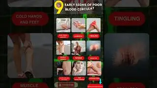 9 Early Signs of Poor Blood Circulation