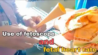 Fetoscope क्या होता है और इसका उपयोग क्यों और कैसे किया जाता है 🖤🤩