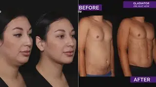Demand for plastic surgery rises during the pandemic