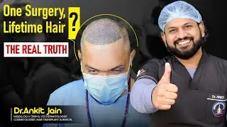 Is Hair Transplant a Permanent Solution? | Dr Ankit Kumar Jain | Hairfree & Hairgrow Bhopal