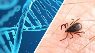 Natural Remedies for Chronic Lyme Disease