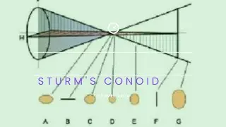 Sturm's conoid medico | astigmatism types and sturms conoid | Sturm's conoid explained