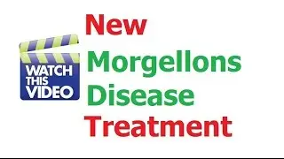 Morgellons Disease Treatment  for Instant Relief - Stops Crawling Sensations Instantly