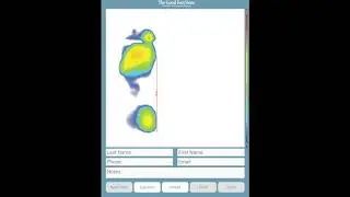 Foot pressure mapping. Surface mapping of feet. Plantar foot surface pressure.