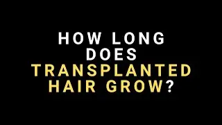 How Long Does Transplanted Hair Grow after a Hair Transplant? (Body Hair and Scalp Hair)