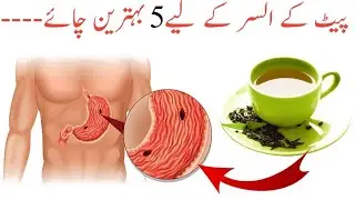 Best tea for stomach ulcers in Urdu | best tea for stomach issues.
