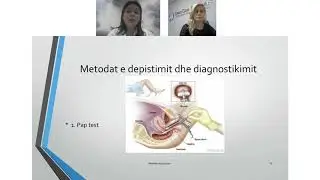 Infeksioni i HPV dhe raportet ne çift: Çfare duhet te dime?