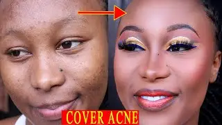 HOW TO COVER UP ACNE WITH MAKEUP