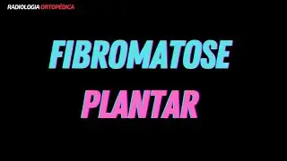 Pé - Fem, 40 anos, pedido médico de metatarsalgia... mas tem mais coisa!