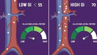 What Is GI?