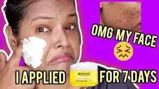 OMG I Applied Garnier Bright Vitamin C Complexion Cream For 7 Days|Garnier Bright Cream|Shinny Roops