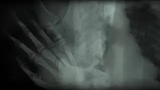 X Ray Background