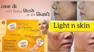 How to use Light n skin cream || hyper pigmentation & dark spots ko remove kare ||