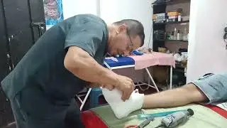 How to Remove a Cast from a Foot