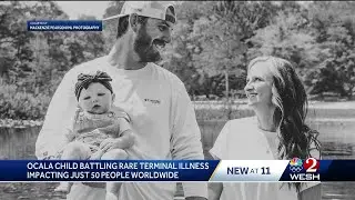 'I was crushed': Marion County parents spread awareness after 1-year-old daughter diagnosed with ...