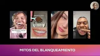 blanqueamiento dental  