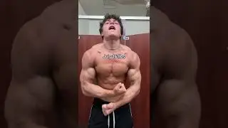 Is this natty??😳💉