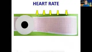Simple ways to determine the heart rate on ECGs of dogs and cats